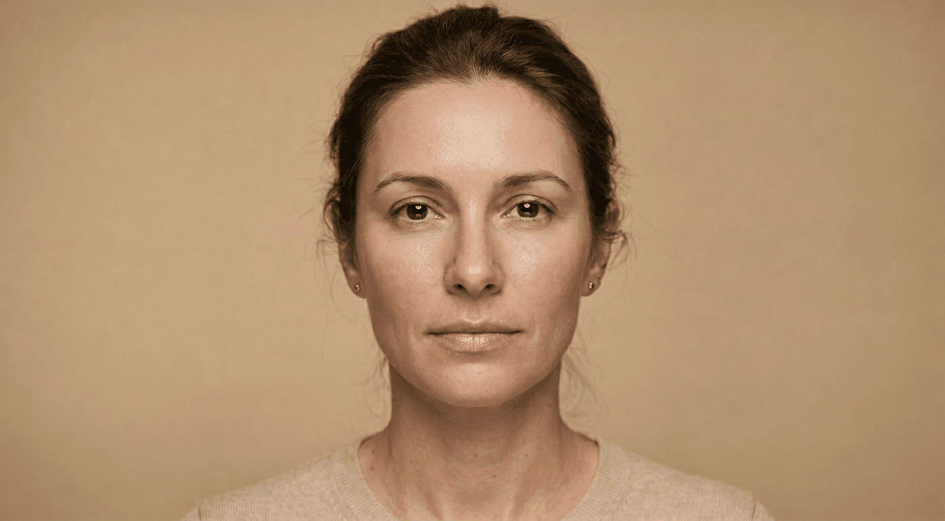 Microneedling in Nürnberg für strafferes und ebenmäßigeres Hautbild